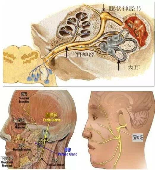 面神经损伤后,由于表情肌瘫痪,出现串侧眼不能闭合,流口水,口歪向健侧