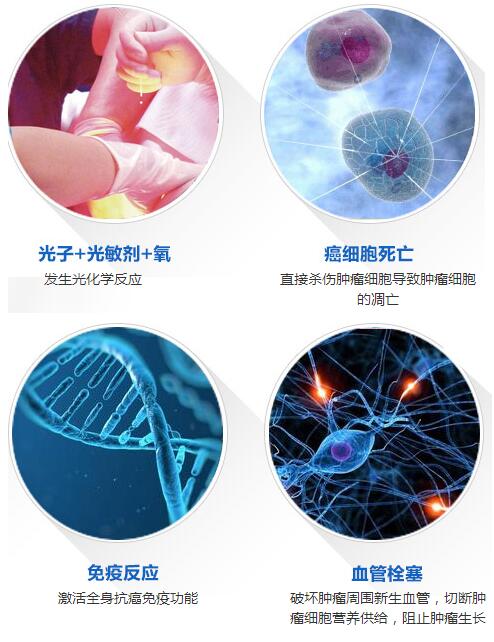 光动力疗法与超脉冲co2激光治疗尖锐湿疣疗效观察