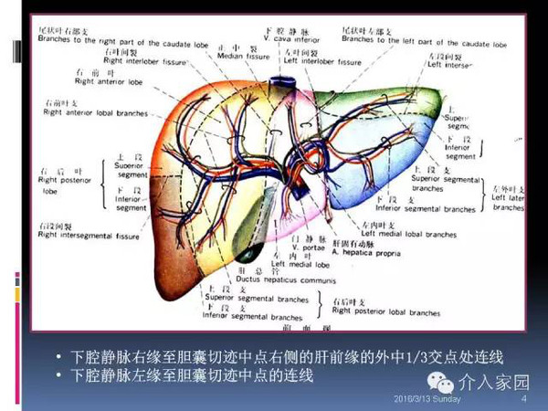肝脏分段及血管详细辨识教程断层解剖影像学