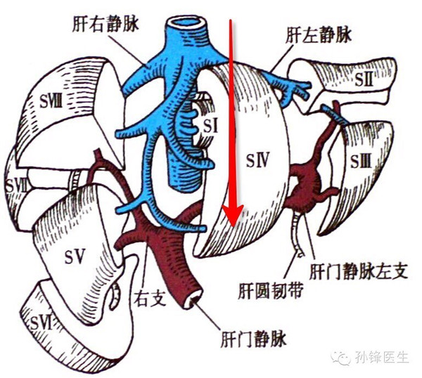 图(5:由头侧向尾侧,肝静脉分支逐渐远离下腔静脉3利用刚才学过的知识