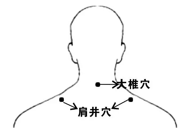 成语十什么如椎_成语故事简笔画(2)