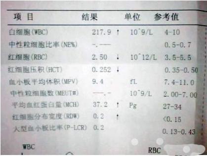 如何读懂孩子验血报告单?爸妈一起学!