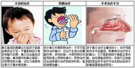 儿童鼻炎症状解析,治疗预防才是关键!