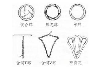 科普取环手术全过程图解备孕的你必须懂