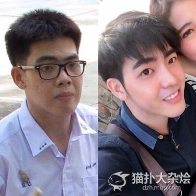 人艰不拆 泰国质朴小哥花百万整容变网红帅哥