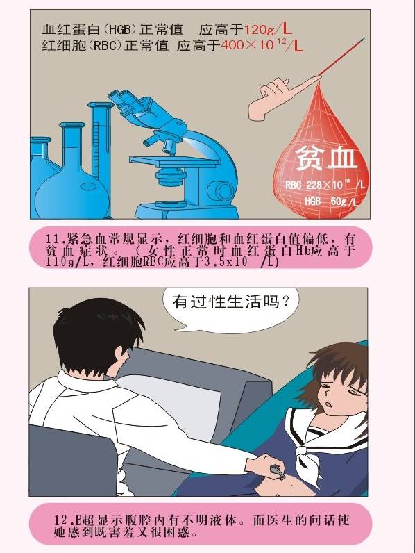 图解疾病宫外孕