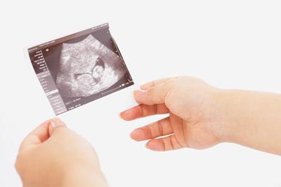 孕妇临产前胎动减少 正常吗?
