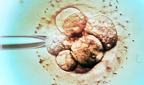 泰国试管婴儿囊胚移植的优缺点是什么?