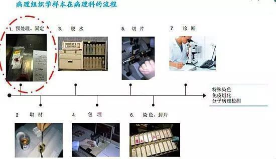 其中与临床联系最紧密的一步是标本预处理固定(即送达病理科前的标本