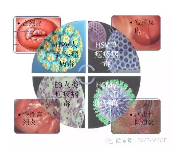 hpv全称人乳头瘤病毒(human papilloma virus,是一类具有高宿主特异