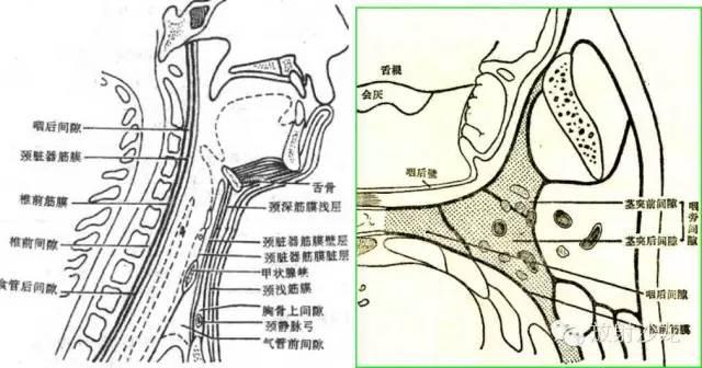 2,咽后间隙 上达:颅底 下至:达下咽部和食道后面至后纵隔 前壁:颊咽