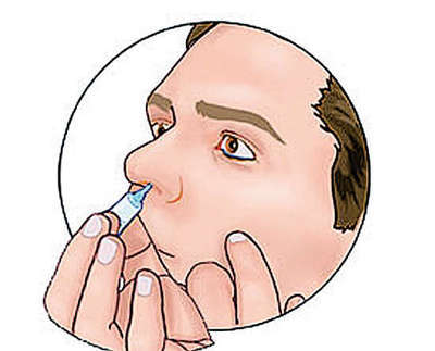 鼻癌早期和晚期怎么看