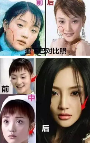 深扒李小璐十年整形路