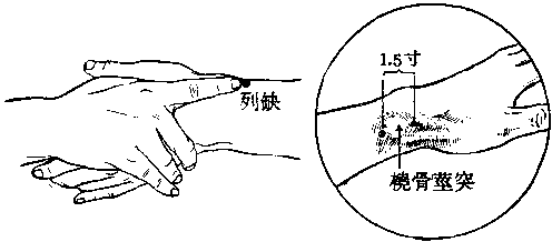 头颈僵痛 可试试肺经的列缺穴,"头项寻列缺".