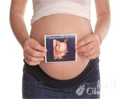 孕期必做检查项目, 四维彩超什么时候做最好?