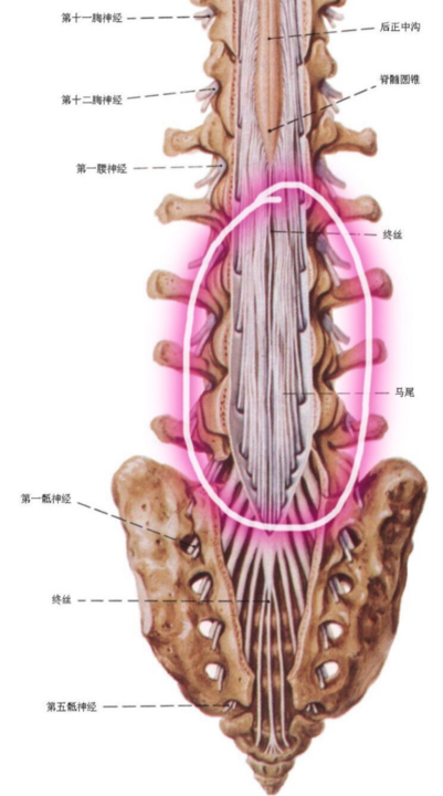 从图上看出:l2-3,l3-4,l4-5,l5-s1都算安全穿刺间隙.