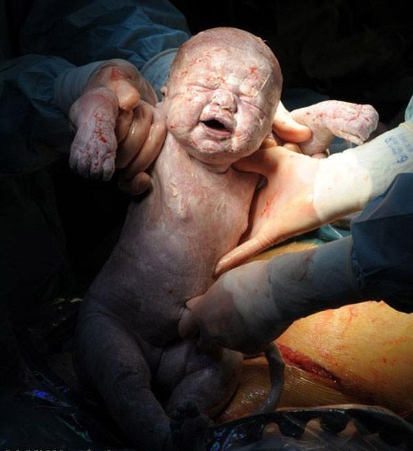 婴儿出生后时刻的一系列震撼照片 你们保证没看过