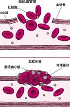 血小板低的人该怎么办