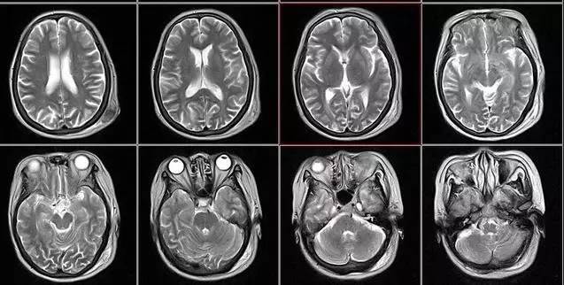 医疗影像技术简介（X射线，CT，MRI等）