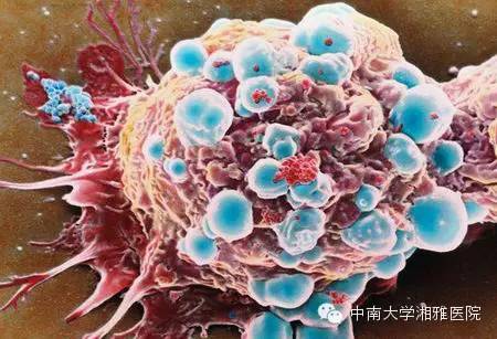 乳腺癌干细胞的生物学特性与治疗前景