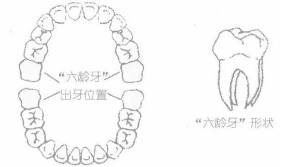 母婴 正文"六龄牙:是指儿童生长的第1个恒磨牙,即第1大臼齿(俗称