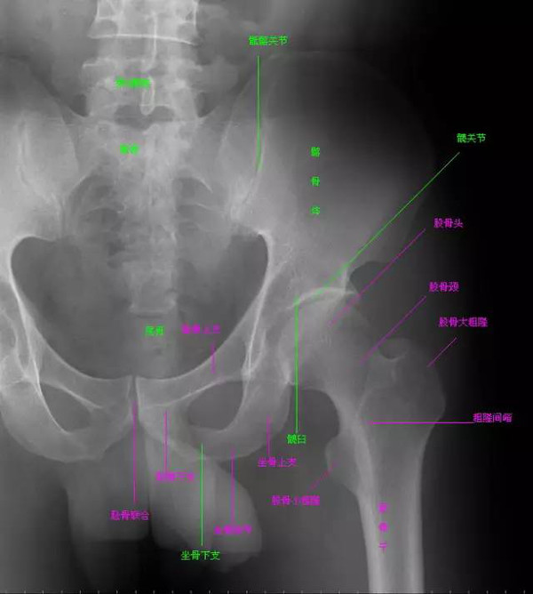 骨盆x线解剖详解三步走