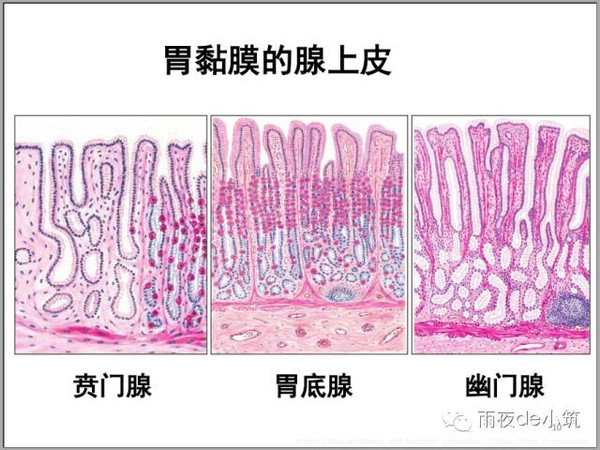 早期胃癌病理学习笔记-part1