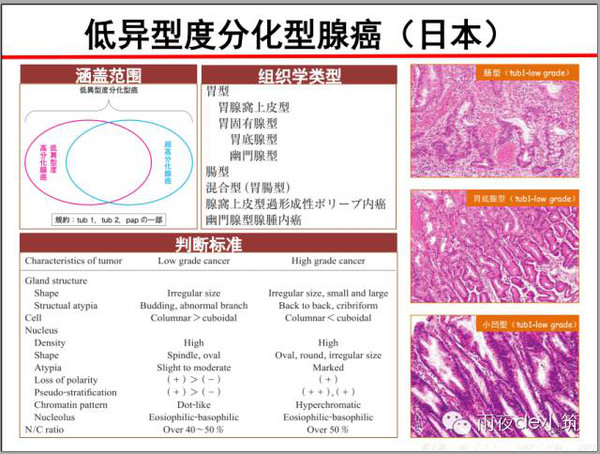 早期胃癌病理学习笔记-part1