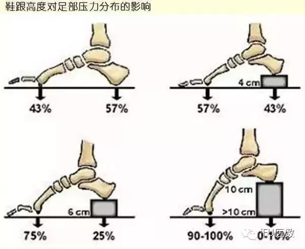 趾什么前成语_趾疣是什么(3)