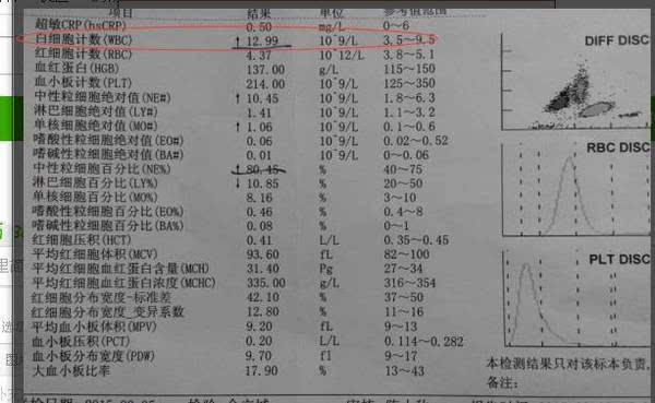 因为通过血常规检查,不仅可以有效判断孩子到底是病毒感染还是细菌