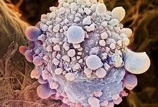 教你看懂乳腺癌免疫组化报告单