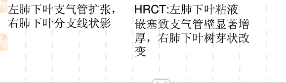 异物吸入弥散性吸入性细支气管hrct表现有小叶中心结节,单侧或双侧