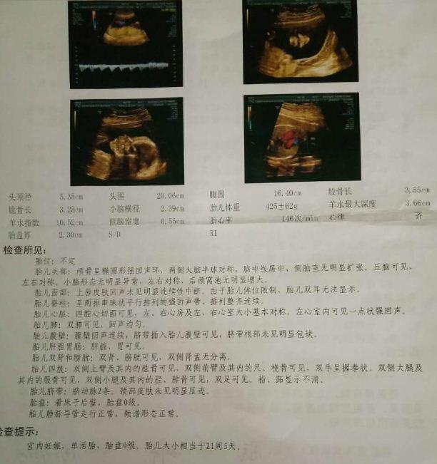 左肩前(lsca,左肩后(lscp,右肩前(rsca)