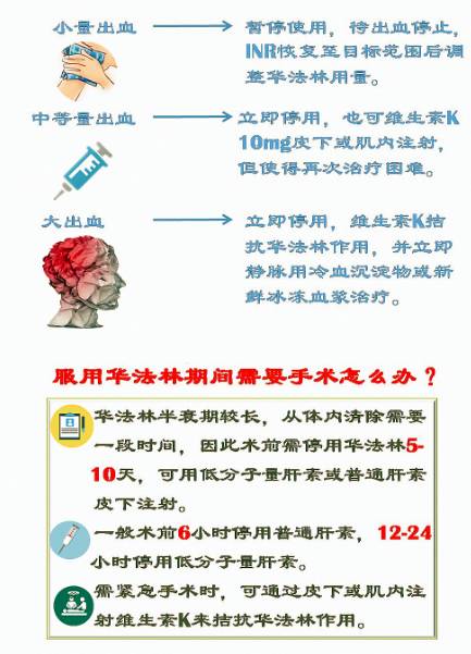 华法林的合理应用一图足矣