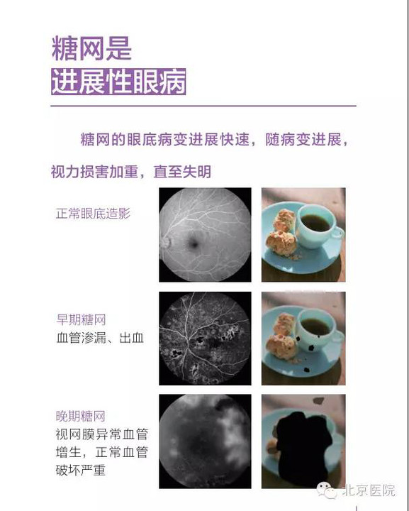 北京医院眼科将于下周一举办国际爱眼日义诊