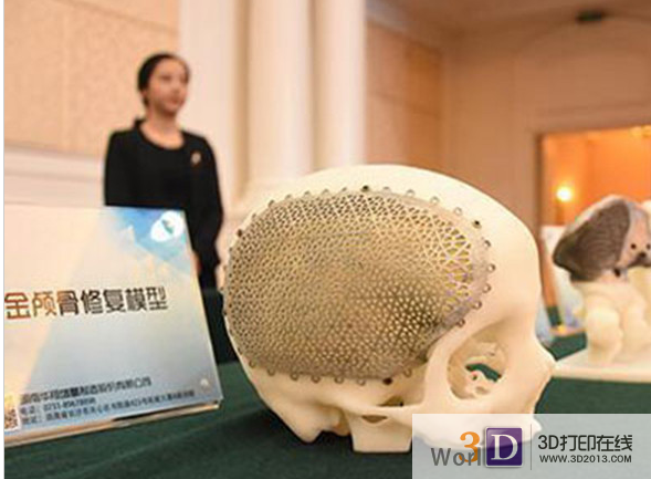 中国湖南欲打造3D打印技术生物医学产业基地
