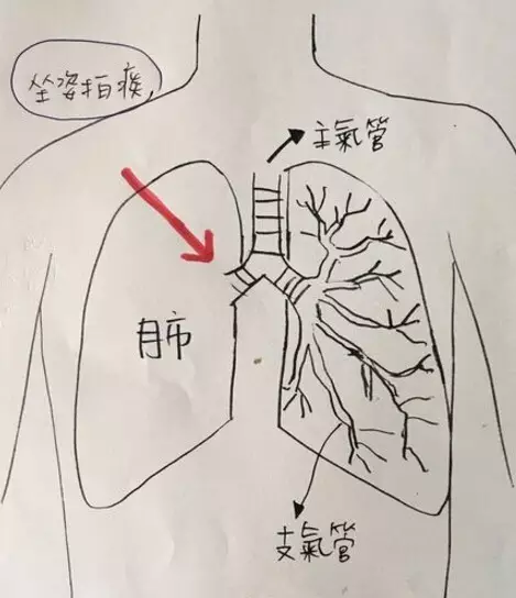 痰的原理是什么_肺癌的血痰是什么颜色