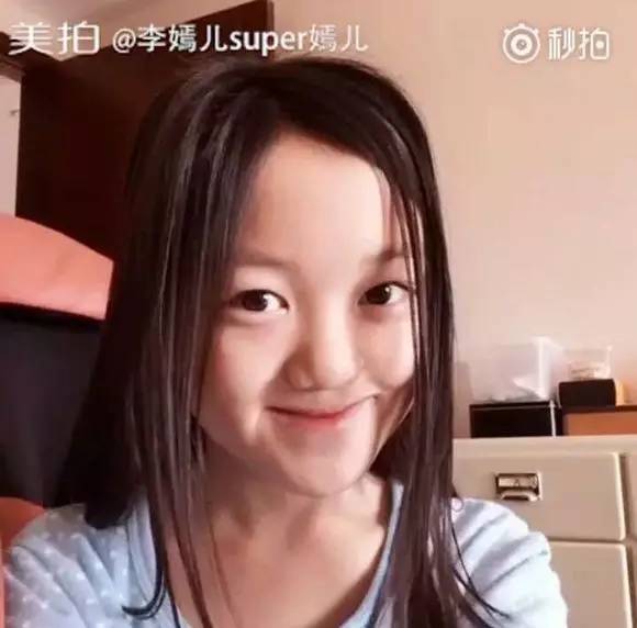 王菲女儿天生兔唇缺陷却依旧长成了最美的样子