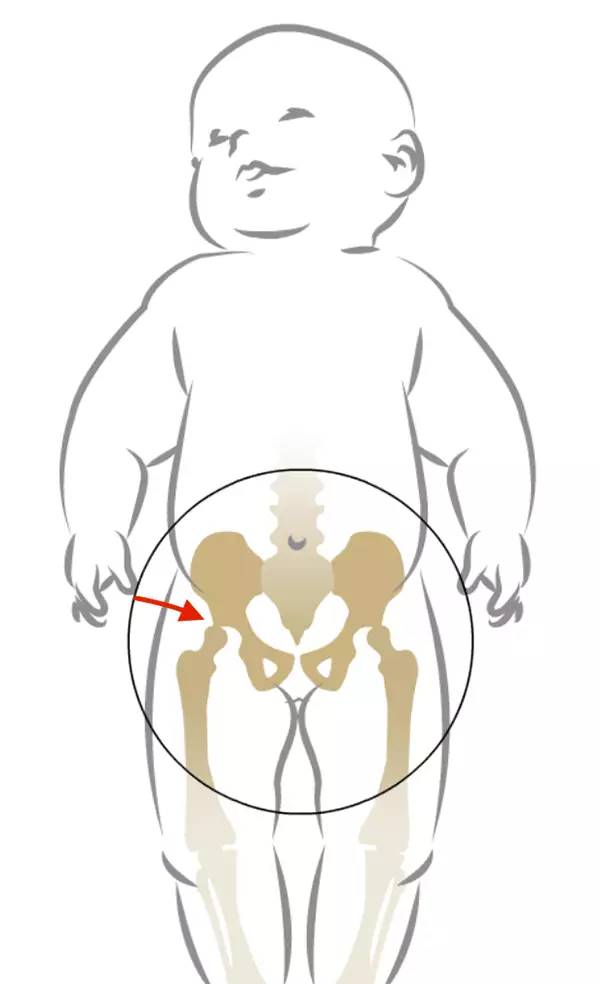 给宝宝绑腿能让腿变直么?儿科医生说这么做没