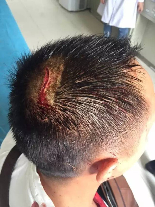 声援丨导游王伟,在九寨沟景区内被黑店家殴打