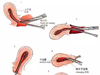 人口萎缩_今日大学生 做到这六点,才叫好大学(2)