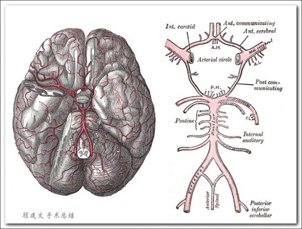 脑梗死患者脑血管病变及侧支循环的研究