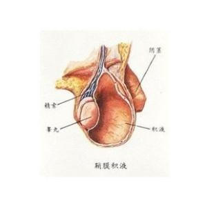 疝气拖了一晚,儿子竟再也无法生育!怎么判断孩子