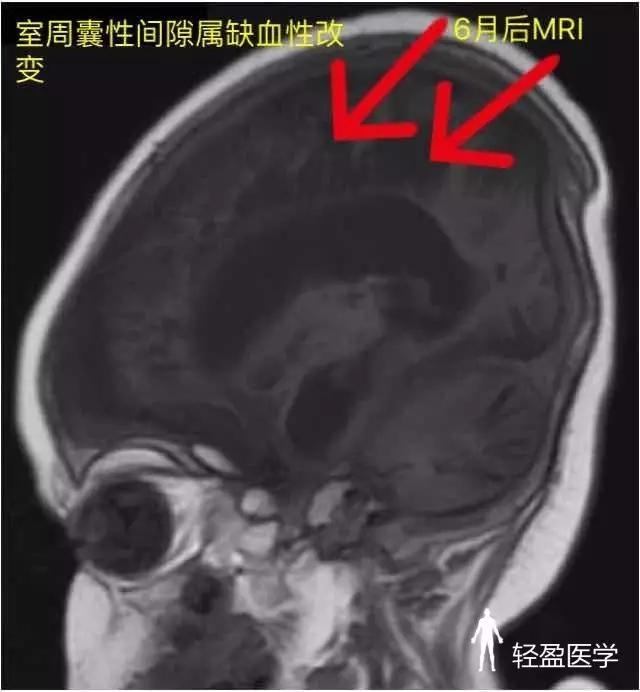 成人口水多是什么原因(2)