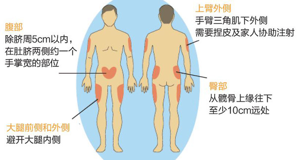 端午佳节,抓牢血糖监测不放粽!