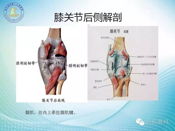 胫骨平台骨折MFB分型-MFB?1a-d型(连载第二