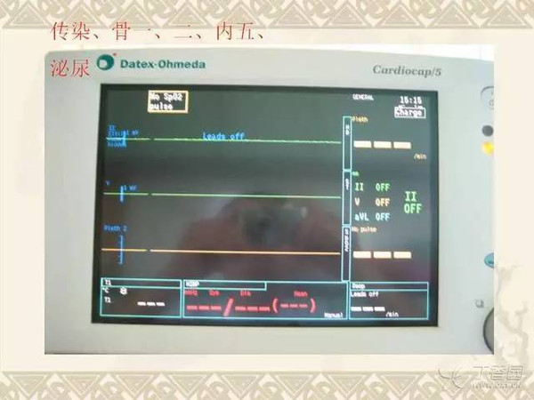 心电监护仪的操作指导与注意事项