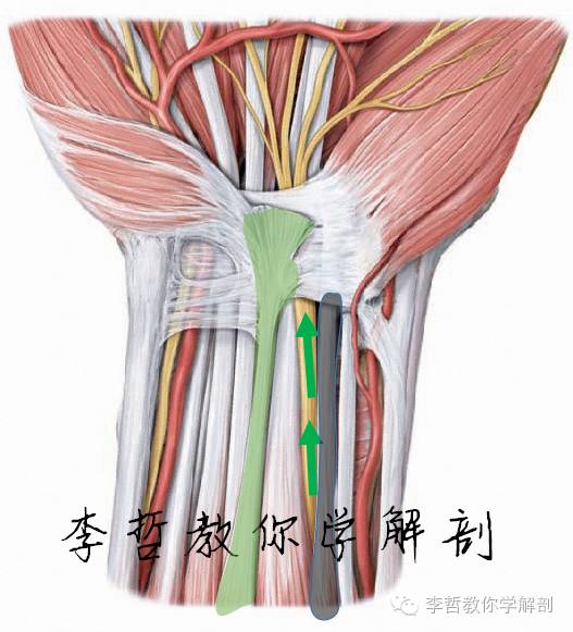 然后自桡侧腕屈肌腱(黑色)和掌长肌腱(绿色)位之间进入腕管