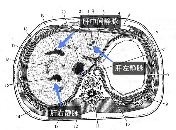 原创|一分钟学解剖:经胃贲门的横断层解剖