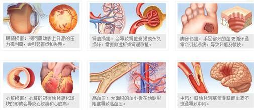 糖尿病对人体的危害